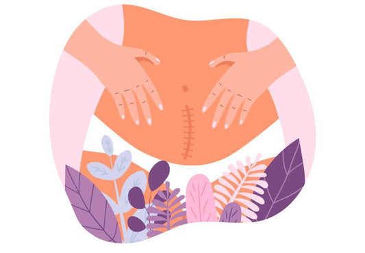 Recovering from a C-Section - Mari Kali Stores Cyprus